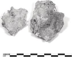The platform is made of metal and glass. Pathology Part Ii Palaeopathology