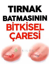 Pin On Saglik Bilgileri