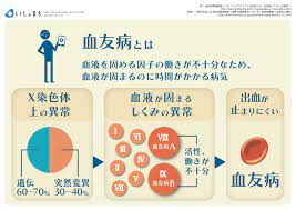 血友病とは infographics 医学 医療 生理学