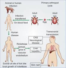 Image result for Rickettsiae
