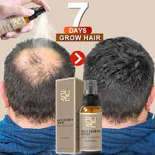 Buy the best and latest hair grow spray on banggood.com offer the quality hair grow spray on sale with worldwide free shipping. Purc 2019 New Hair Growth Spray Fast Grow Hair Hair Losstreatment Preventing Hair Loss 30ml Hair Scalp Treatments Aliexpress