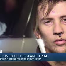 Peoria man facing aggravated assault charges after being shot in the face  by police