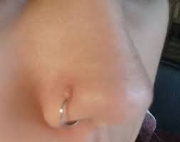 Nose Piercing Bump After 3 Years Piercing
