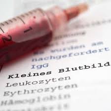 Was Die Abkurzungen Beim Blutbild Bedeuten Gesundheit