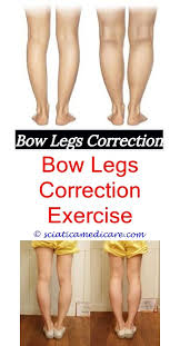 Leg Braces For Toddlers Bow Legged Correction Knock Knees Bow Legged