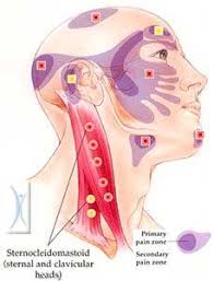 Pin On Health Myofascial Release Trigger Point