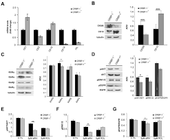 Get the latest corbus pharmaceuticals stock price and detailed information including crbp news, historical charts and realtime prices. Cellular Retinol Binding Protein 1 Transfection Reduces Proliferation And Akt Related Gene Expression In H460 Non Small Lung Cancer Cells Springerlink