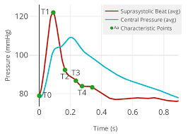 Image result for Pulse Pressure