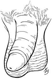 Continue reading below to learn more about what causes curved toenails. How To Deal With A Bent Penis Dummies
