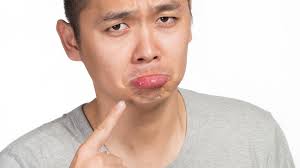 He gives me worried looks if i scratch or have an uncomfortable face. Dating Sites For People With Herpes Aren T All They Re Cracked Up To Be