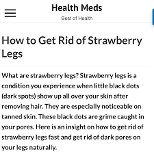 Antibacterial soap can help raise the ingrown hairs on your legs, which is going to make it easier for you so you can eliminate the hair. How Do We Remove Ingrown Hair And Strawberry Legs Nykaa Network
