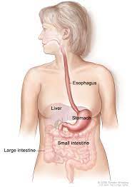 If your doctor thinks you may have stomach cancer, you will be referred for further tests. Gastric Cancer Treatment Pdq Patient Version National Cancer Institute