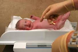 A Perda De Peso Em Recem Nascidos Sou Mamae