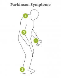 Parkinson's disease is a progressive nervous system disorder that affects movement. Parkinson Symptome Diagnose Test Pflege De