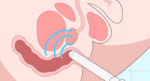 Simple Ways To Relax Your Sphincter Muscle: 9 Steps
