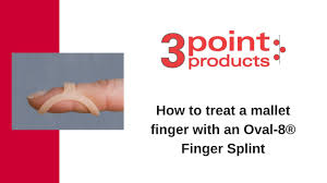 With mallet finger, the tendon on the back of the finger (not the palm side) is separated from the muscles it connects. How To Treat A Mallet Finger With An Oval 8 Finger Splint Youtube