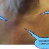 The lungs are separated from each other by the mediastinum. 1
