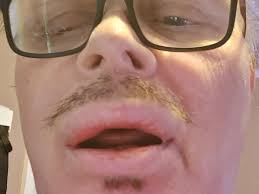 Fundraiser by Robert Tossava : Adventures For Dentures