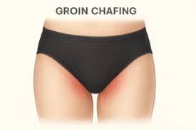 Image result for sore skin in the groin area
