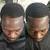 Black Man African American Alopecia