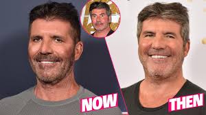 The couple has one son together, but they've also faced some scrutiny in their relationship. Simon Cowell Plastic Surgery Makeover Exposed By Top Docs