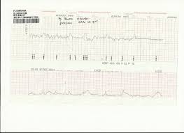Oleh karena itu sangat disarankan untuk berjemur sebelum jam 9 pagi untuk mendapatkan sinar matahari dengan kualitas yang baik untuk kulit. Muhammad Umar Alfaruq Kehamilan Dan Proses Kelahiran Keluarga Zulfikar