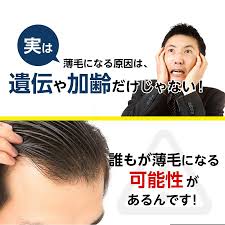 育毛剤 120ml 育毛 トニック ヘアトニック スカルプ エッセンス 増毛 薄毛 対策 頭皮 育毛ローション 薬用 メンズ 男性用 Leomen Lmn 003 Nw Beauty Cart Yahoo 店 通販 Yahoo ショッピング