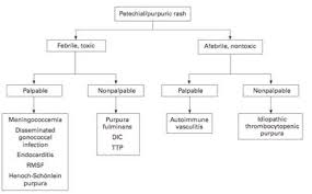 Purpura that does not lower platelet levels (nonthrombocytopenia) has a range of causes and risk factors, including: Https Www Grepmed Com Q Petechial 20rash 20differential