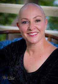 Pin On Alopecia Awareness