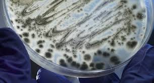 Aspergillus fumigatus is a saprotrophic fungus; Sabotage Von Fresszellen Aspergillus Fumigatus Tarnt Sich Mit Melanin Biermann Medizin