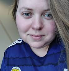 Do people still eat deviled eggs?