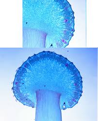 Pin Op Bacteria Fungi