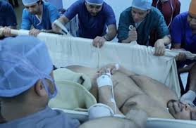 بالصور إجراء عملية تكميم معدة لـ أسمن رجل في مصر منوعات