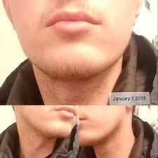 30ml painless hair removal spray stop hair growth inhibitor facial removal cream spray shrink pores skin smooth repair. Wild Willies Beard Growth Supplement 60 Capsules Walmart Com Walmart Com
