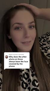 Replying to @Evan It’s the audacity of people for me. It is me in all pics.  13 stone weight loss and yes for full transparency I have loose skin like  anyone who loses that amount of weight.