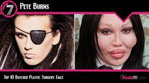 If you're not happy with the b. Top 10 Botched Plastic Surgery Fails Before And After Album On Imgur