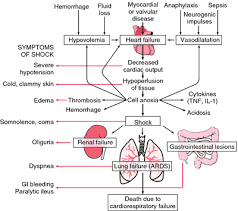 Shock Flowchart Septic Shock Nurse Practitioner Online