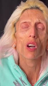 Rachael's Recovery Update and LiVe ChaT.. 💇‍♀️🌈🦄🎨