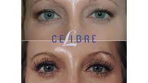 Latisse Change Eye Color