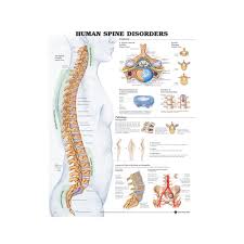 anatomical chart human spine disorders