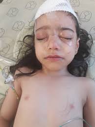 Wrong Use of Oxygenated Water to Preparation the Skin before Surgery