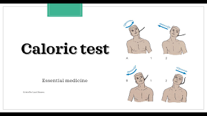 Image result for Oculovestibular Testing