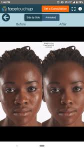For nose jobs, chin augmentation, liposuction, breast reshaping and more. Facetouchup For Android Apk Download