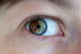 Google Image Result For Http Indianapublicmedia Org Amomentofscience Files 2009 07 2853 940x626 Jpg Eye Color Change Rare Eyes Rare Eye Colors