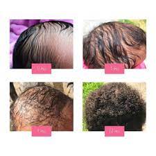 When Did Your Baby S Hair Texture Change R Blackhair