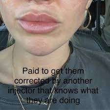 CHRISTOPHER MICHAEL STUTZ, MD