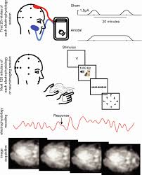 tens electrode placement chart using transcranial direct