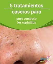 2 Cucharadas De Harina De Garbanzo 20 G 1 Cucharadita De Curcuma 5 G Tratamiento Casero Remedios Caseros Para Las Espinillas Tratamiento Para Las Espinillas