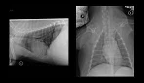 To investigate the mode of clinical onset of pulmonary carcinoma, 232 inpatients with this diagnosis were also stud … Canine Chronic Bronchitis A Review And Update Today S Veterinary Practice
