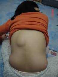 Injected With Unknown Drugs Ms Zhu Yifang Lost The Ability To Walk Photos Falun Dafa Minghui Org